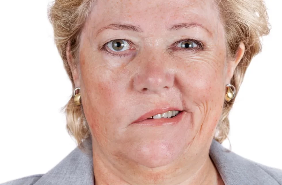 Bell’s Palsy